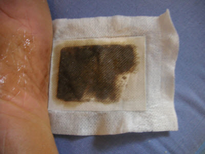 Foot Detoxifying 